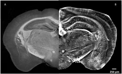 X-ray Phase Contrast Tomography Serves Preclinical Investigation of Neurodegenerative Diseases